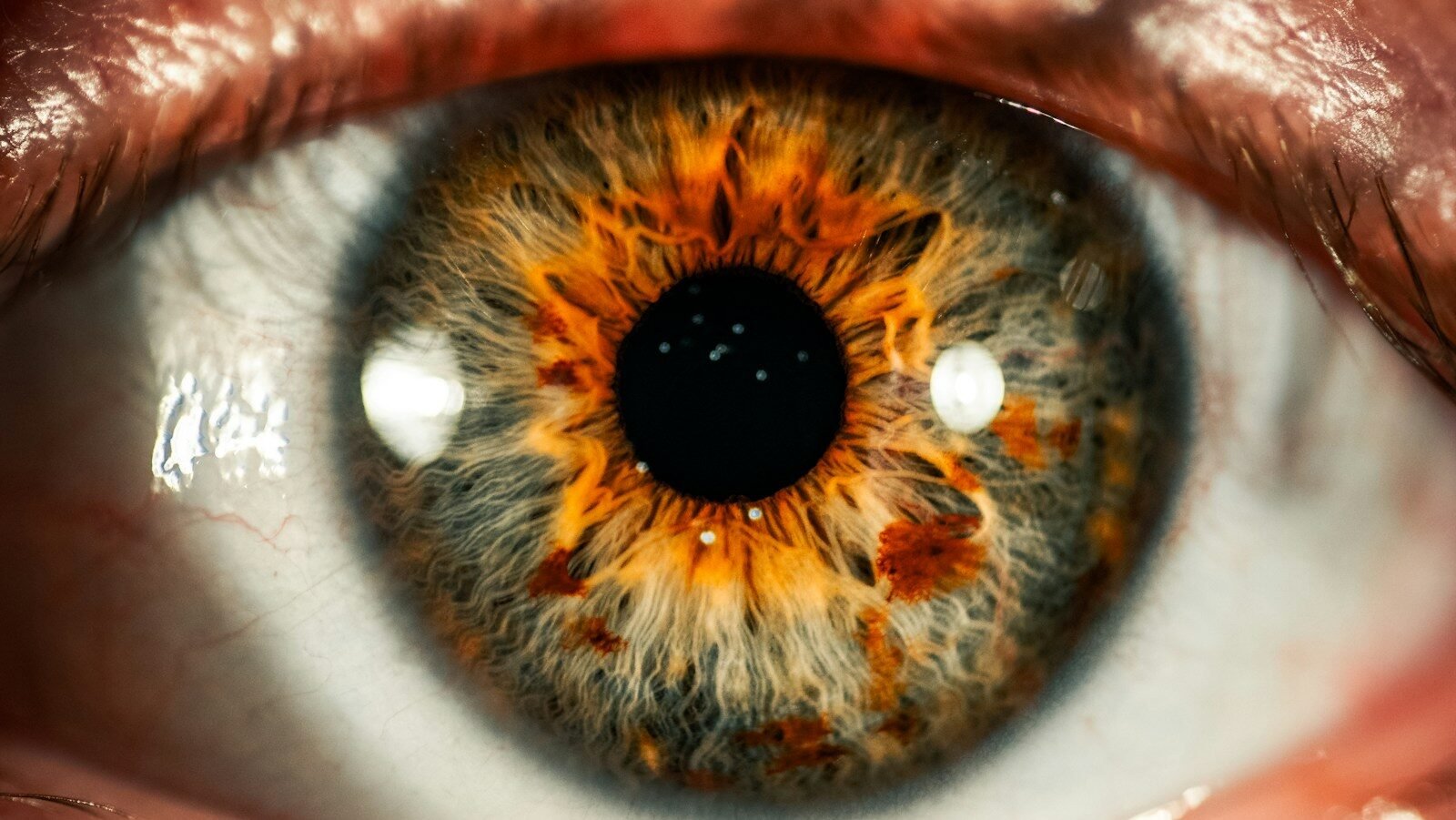A close-up of a human eye with a grey and orange iris
